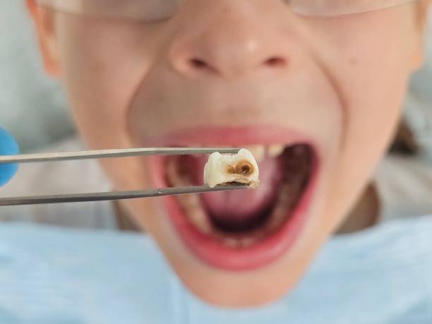 Best Urgent Dental Care  in Simonton Lake, IN
