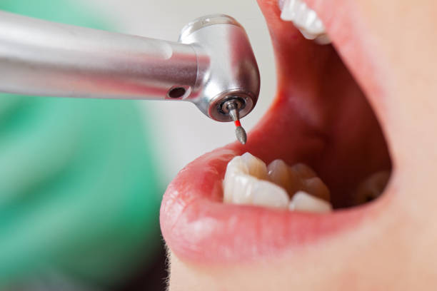 Best Tooth Infection Emergency Dentist  in Simonton Lake, IN